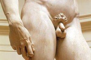 Dick